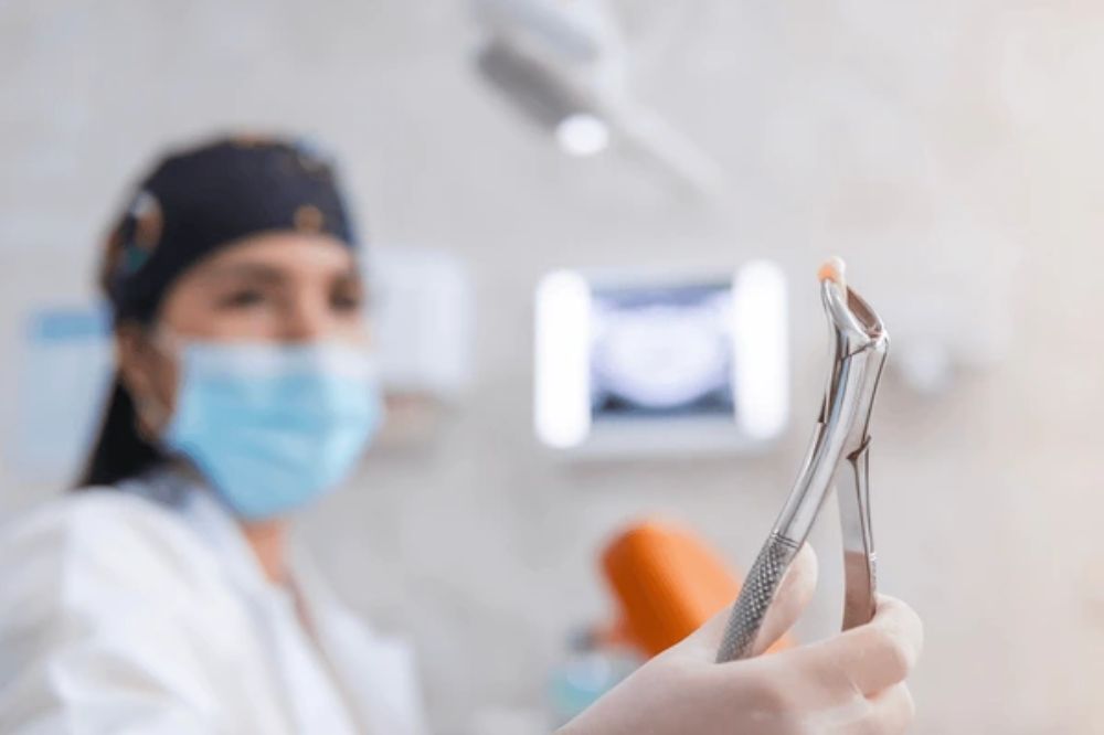 tooth extractions in kingston ontario