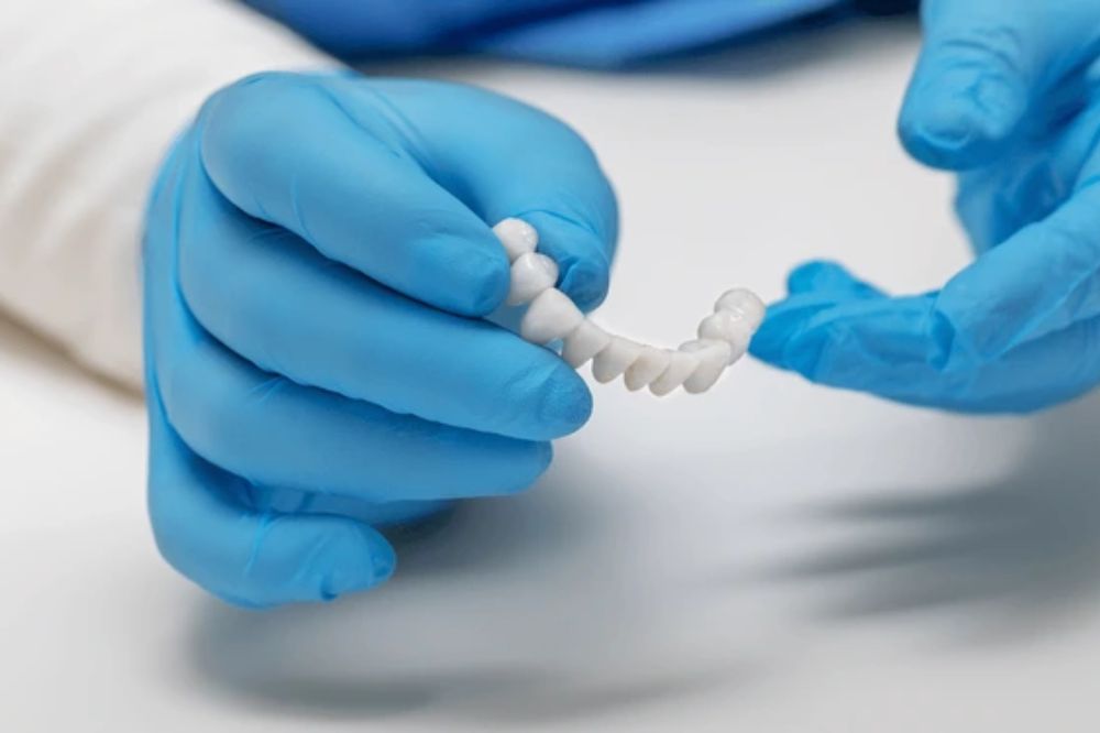 dental crowns in kingston ontario