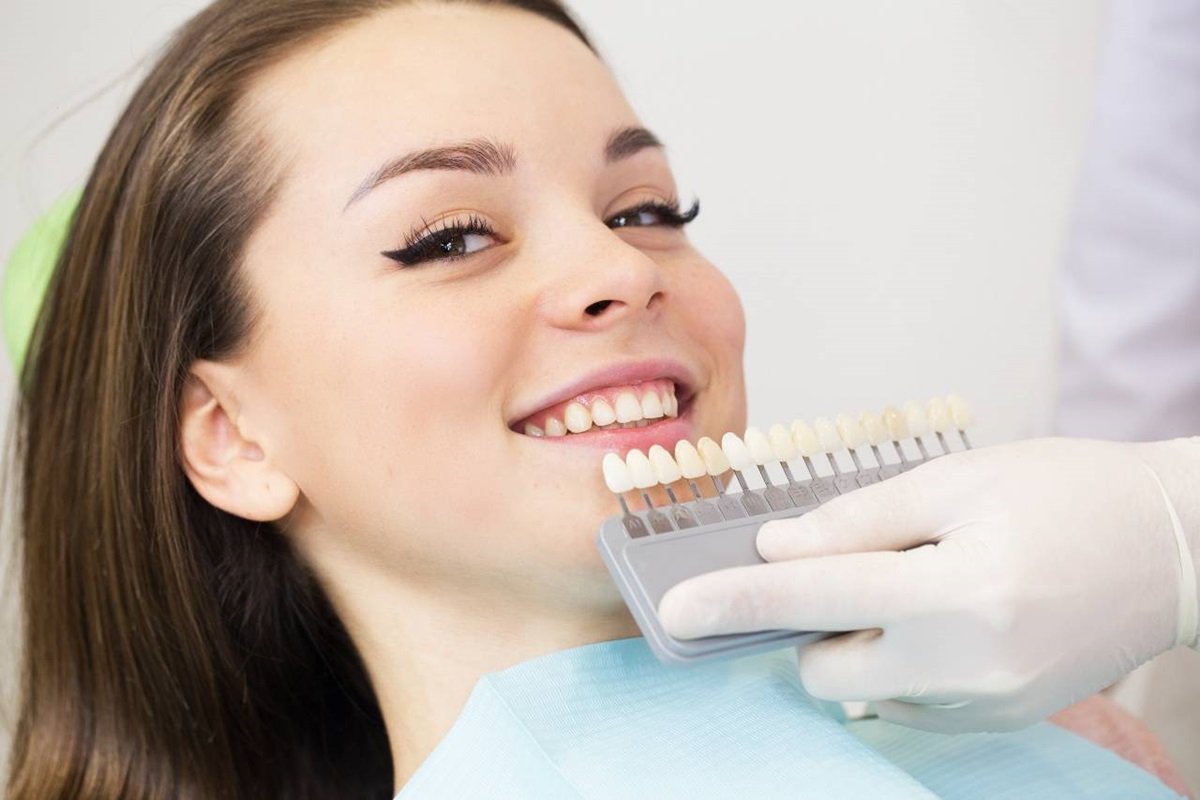5 Clear Signs for Dental Veneers Replacement